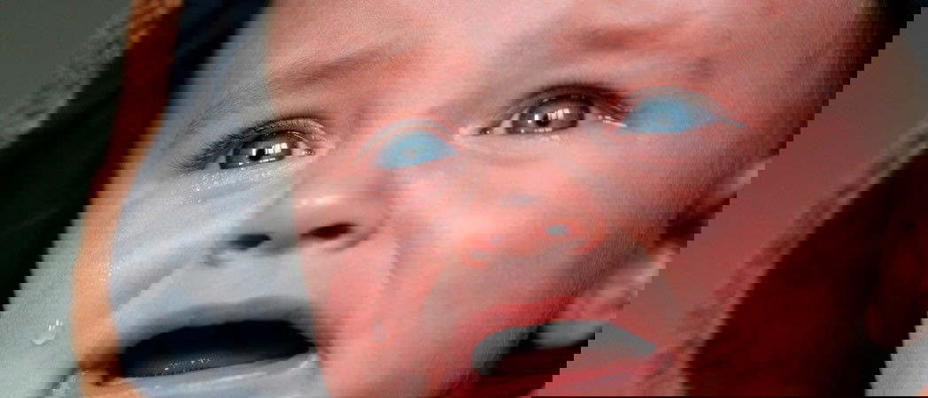 Dermatilomania, my little one scratches and hurts himself